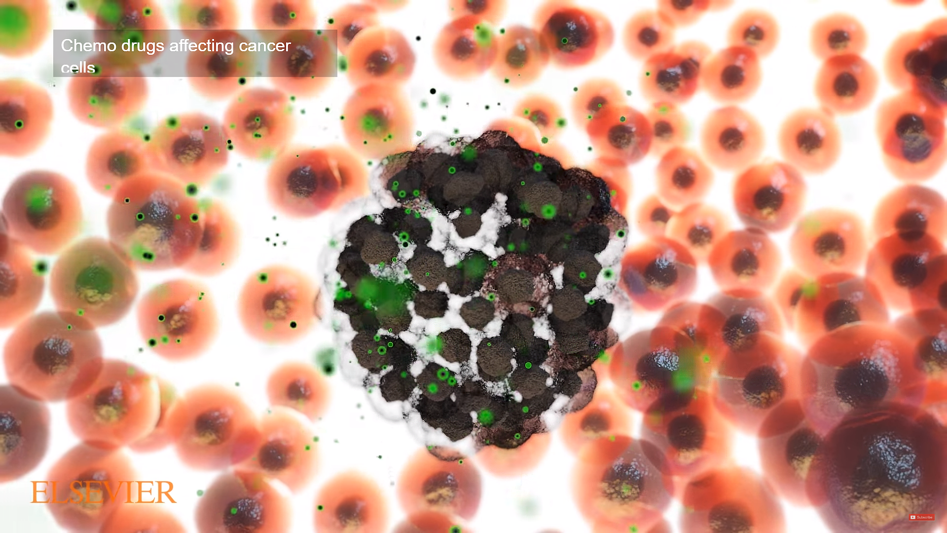 This image is a shot from one of Trinity's medical biological-animation-cellular-structures portraying a tumor after cancerous cells have populated into a lump rendered from Trinity Animation's 3D software. The dark lump is surround by light orange colored cells that are noncancerous. 