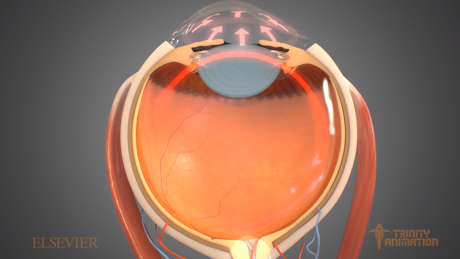 Surgical Animations - Eye and Optical - Trinity Animation | Blog