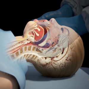 This is a 3D rendered image from the medical animation displaying a jaw-thrust airway position maneuver. The image is also displaying the internal organs inside the head of the figure so they can understand what the procedure is accomplishing.