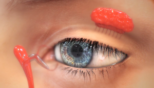 This 3D rendered image from the surgical animations displays an exterior close up of the human eye also featuring interior body parts to allow the viewers to see what is happening inside and outside of the body during Trinity'd eye surgery animations..