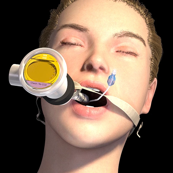 Breathing Tube Animation