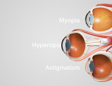 Cross section of three eyes, displaying various afflictions.